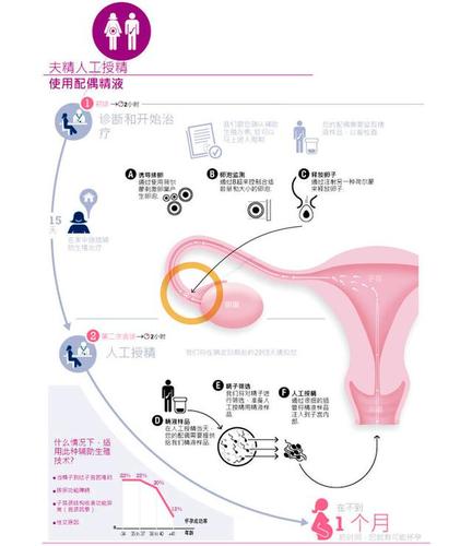 辅助生育技术