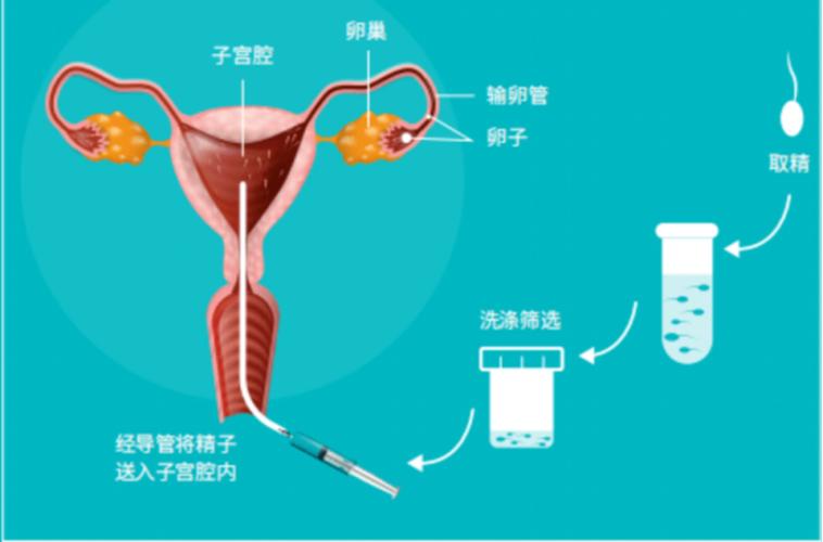 生殖技术