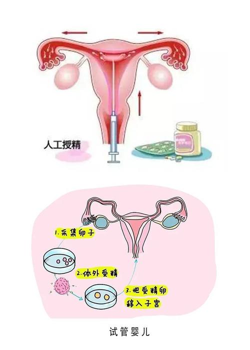 试管婴儿、生殖医学、晚睡影响