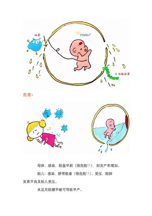 试管婴儿易致早产破水？