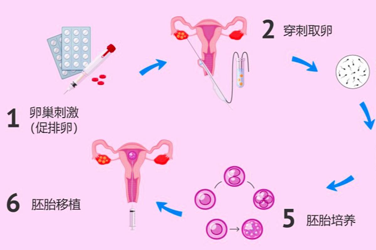 试管婴儿、体检、生殖医疗