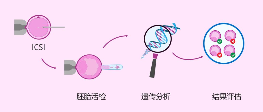 胚胎植入前遗传学筛查