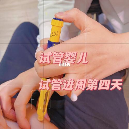 试管婴儿 4 周