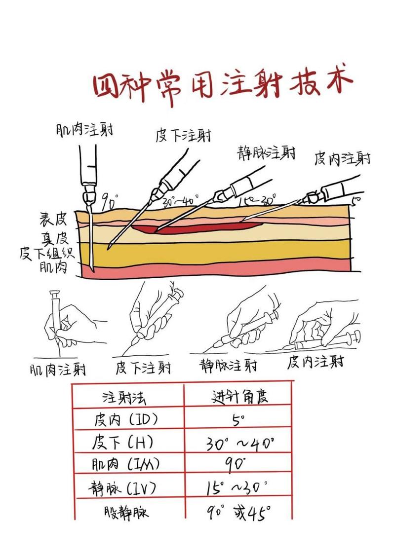 分针操作