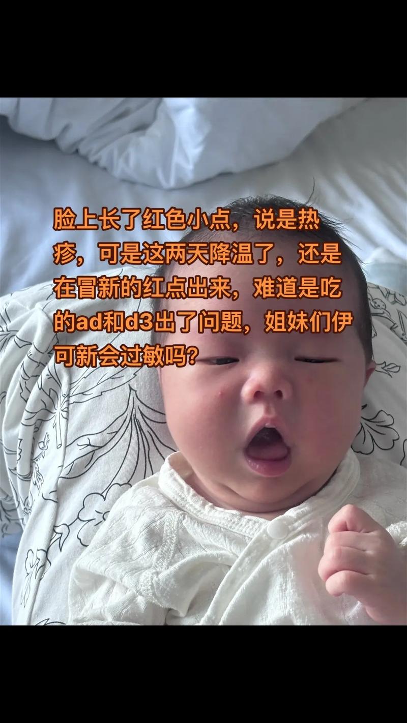 试管婴儿吃优思明过敏怎么办？