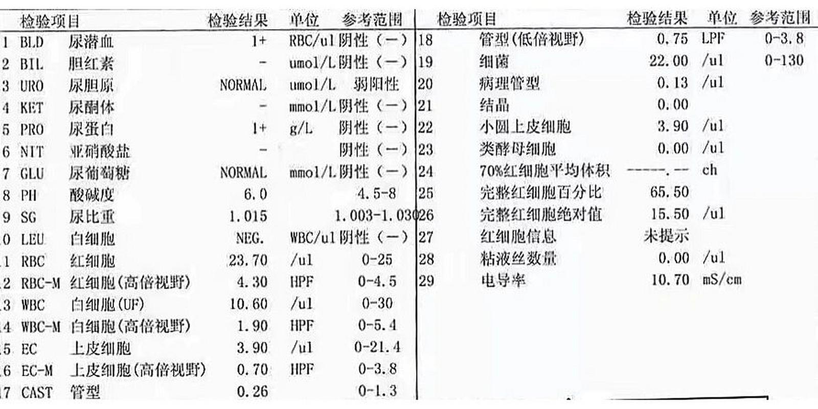 尿液常规检查