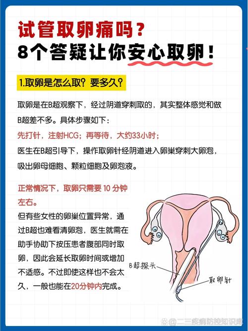 试管婴儿取卵后疼痛