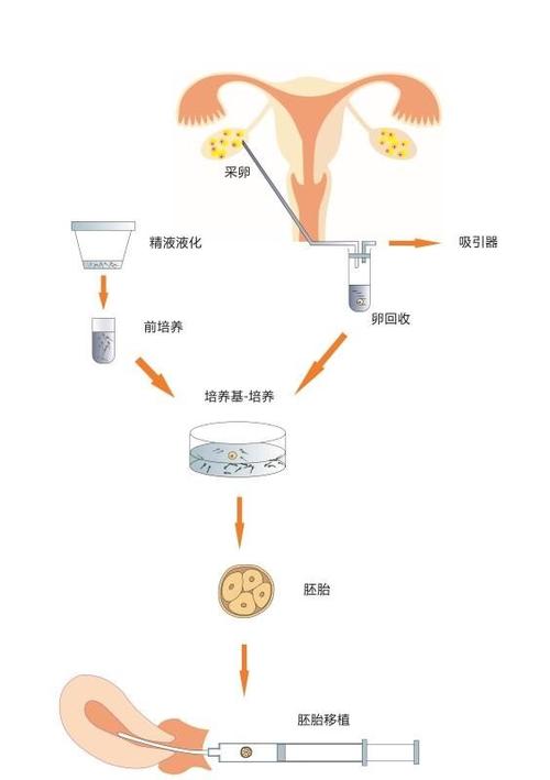 试管婴儿的分娩过程如何进行？