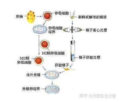  体外受精-胚胎移植技术