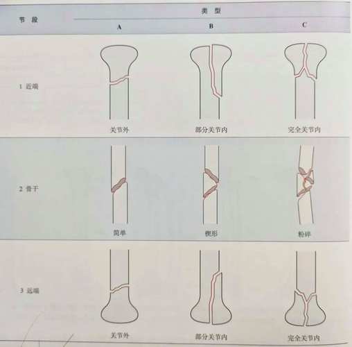 手术类型