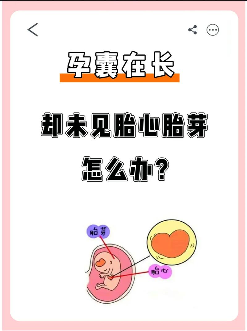 试管婴儿五周未见胎芽：如何应对？