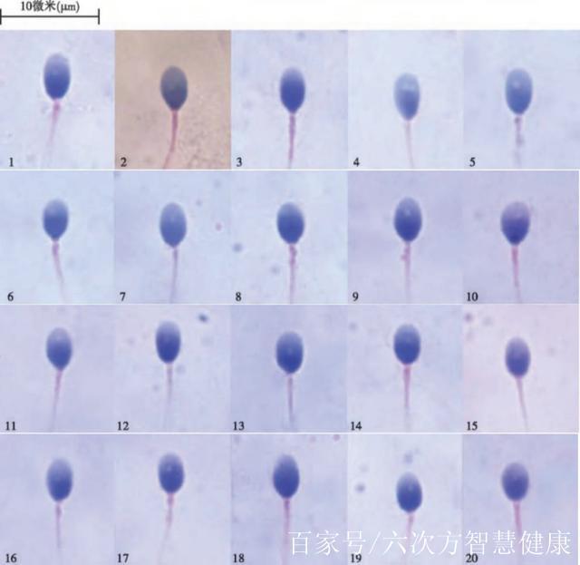 精子形态