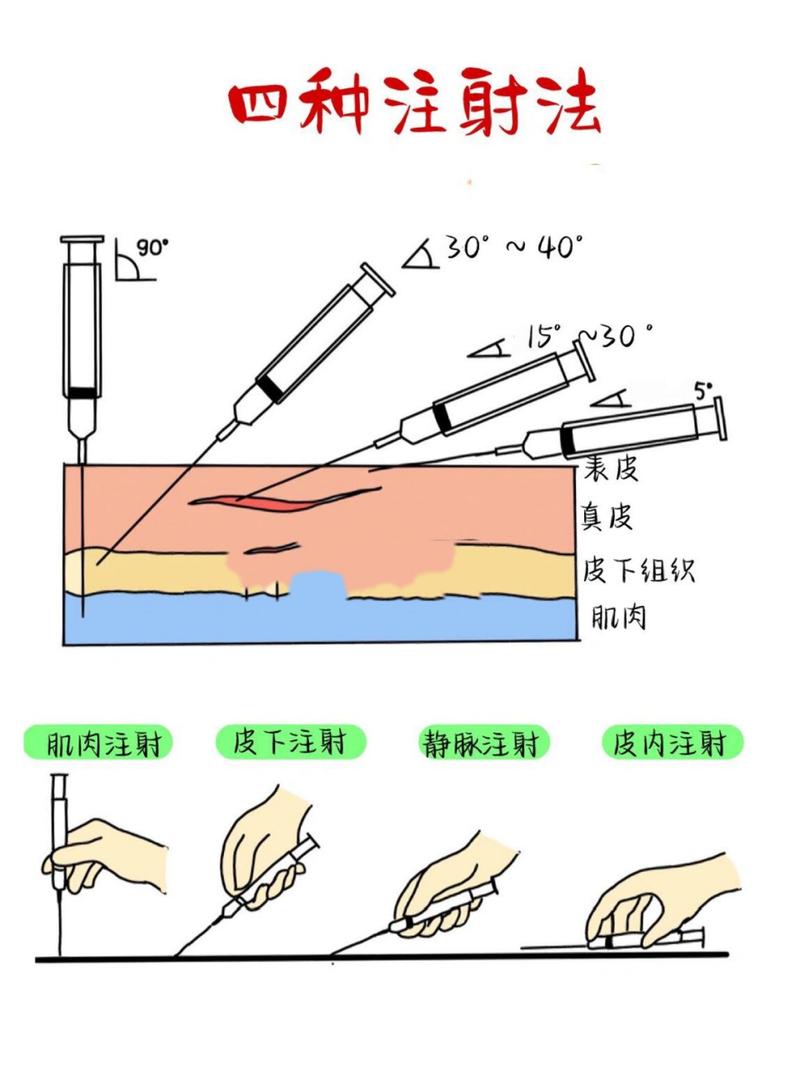 打针必要性