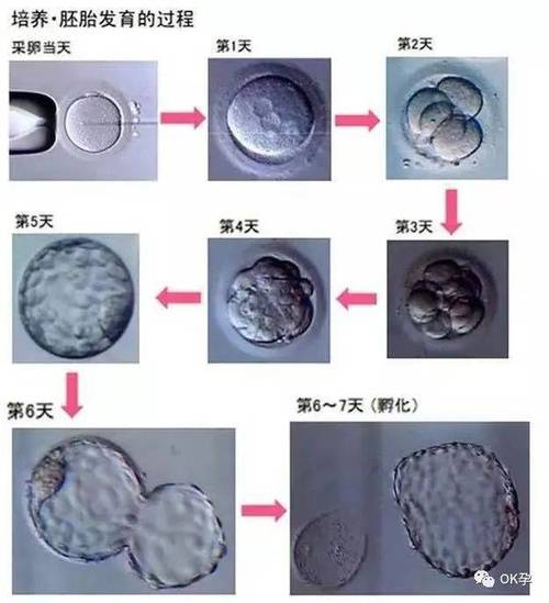 试管婴儿：胚胎为何难成形？