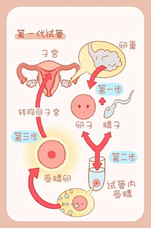 试管婴儿过程有多痛苦？真相揭秘！