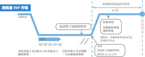  微刺激IVF