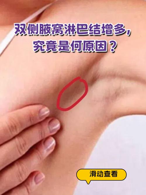 后是否会出现炎症反应？