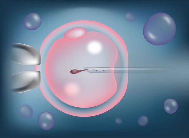 试管婴儿、辅助生殖、怀孕成功