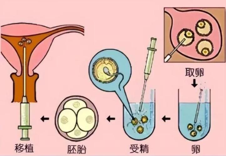 试管婴儿供卵机构