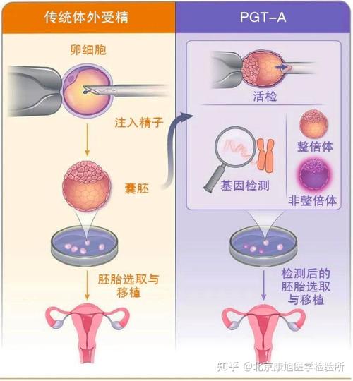  胚胎植入前基因诊断