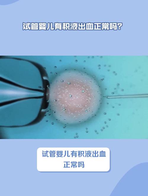 如何辨别试管婴儿腹部积水？